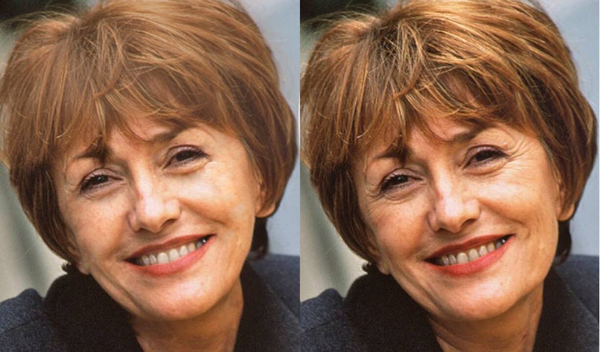 դեմքի լուսանկար ՝ եզրագծումից առաջ և հետո